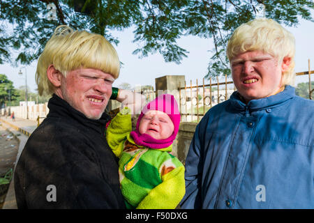 Porträts von albinos mit extrem blasse Haut und weißes Haar, die ihre Augen vor der Sonneneinstrahlung Stockfoto