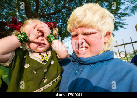 Porträts von albinos mit extrem blasse Haut und weißes Haar, die ihre Augen vor der Sonneneinstrahlung Stockfoto