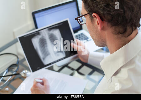 Arzt, Röntgen der Lunge zu betrachten und Diagnose zu schreiben Stockfoto