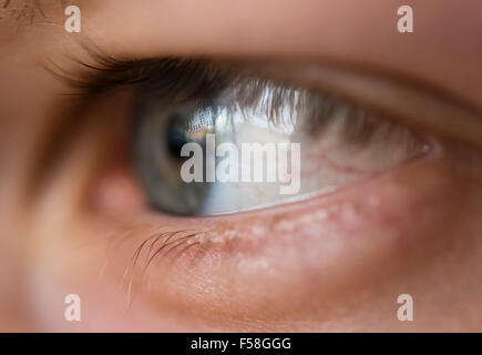 Nahaufnahme eines menschlichen Auges mit einer eingefügten Kontaktlinse. Sichtbare Objektiv Daten Impressum, geschrieben in kleine Punkte auf der Linse Stockfoto