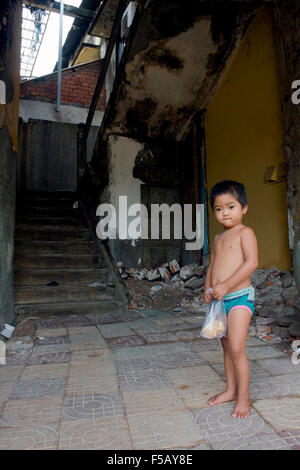 Ein junges Mädchen, das vor kurzem Neurochirurgie Klinik Bopha durchmachten steht in der Nähe von einem Treppenhaus in ihrem Haus in Kampong Cham, Kambodscha. Stockfoto