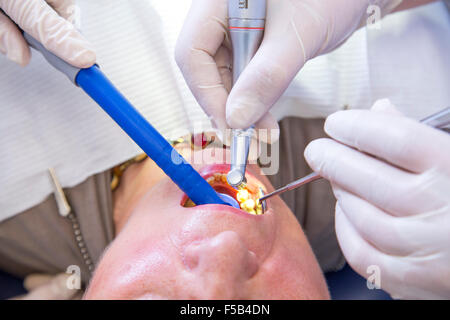 Zahnarztpraxis, Zahnarzt, Assistentin und älteren Patienten, zahnärztliche Behandlung, Vorbeugung, Untersuchung, Check-up, Stockfoto