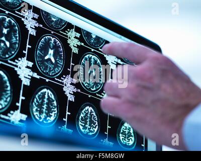 Arzt eine Reihe von MRI (Magnetic Resonance Imaging)-Gehirn-Scans auf einem Bildschirm anzeigen Stockfoto