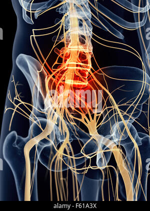medizinisch genaue Abbildung - schmerzhafte sakralen Nerven Stockfoto