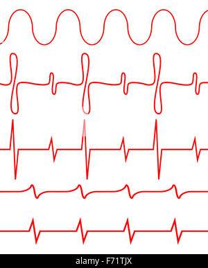 Nahtlose Satz von Linien Herzschlag. Puls-Elektrokardiogramm, Amplitude Gesundheit, Diagnose Krankheit. Vektor Kunst Design Abstrakt unusua Stockfoto