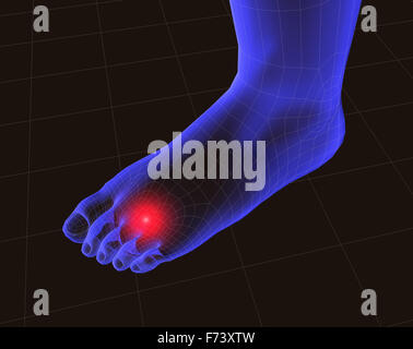 Füße Schmerzen Konzept Stockfoto