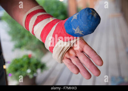 Weiße und blaue Rotstich mit amerikanischen Flagge auf Mannes patriotischen Cast für gebrochene hand Stockfoto