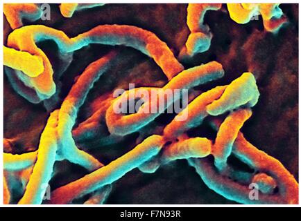 Produziert vom nationalen Institut der Allergie und Infektionskrankheiten (NIAID), unter einem sehr hohen Vergrößerung, diese Digital-eingefärbte Scanning Electron Micrograph (SEM) schildert filamentösen Ebola virus angehende Partikel von der Oberfläche einer Vero Zelle der afrikanischen grünen Affen Niere Epithelzellen. Stockfoto