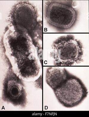 Hohe Vergrößerung von 150.000 X, negativ gefärbten Transmission Electron Micrograph (TEM) Einige der Ultrastruktur Morphologie durch eine Reihe von verschiedenen Mikroorganismen ausgestellt aufschlussreich. Verkleidung "A" stellt einen Composite Schliffbild, zum Vergleich der Größe Unterschied zwischen einem Poxvirus an der Spitze, ein bazillus, der in der Mitte und einem Herpesvirus an der Unterseite. Panels 'B', 'C' und 'D' sind Systeme, die die fortlaufende Degeneration des variola Virus patricles. Stockfoto