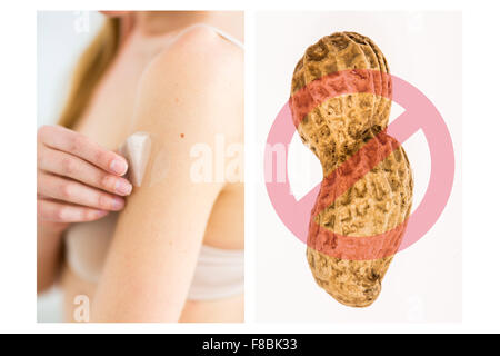 Composite auf Behandlung gegen Allergien gegen Erdnüsse pro Patch.