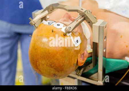 Chirurgische Behandlung der Parkinson-Krankheit durch tiefe Hirnstimulation mit Rosa® Roboter, Krankenhaus in Amiens, Frankreich. Stockfoto
