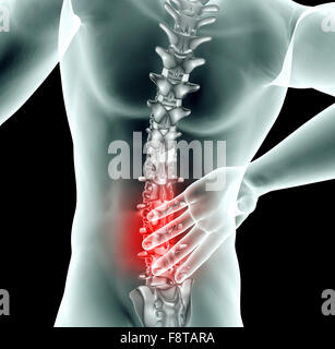 Röntgenbild eines Mannes mit Rückenschmerzen auf schwarz mit Beschneidungspfad. Stockfoto