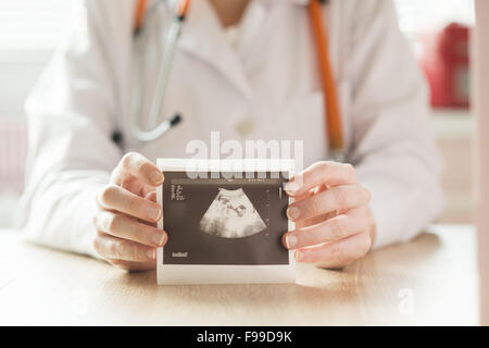 Detail der Ärztinnen Hände halten Ultraschallbild Stockfoto