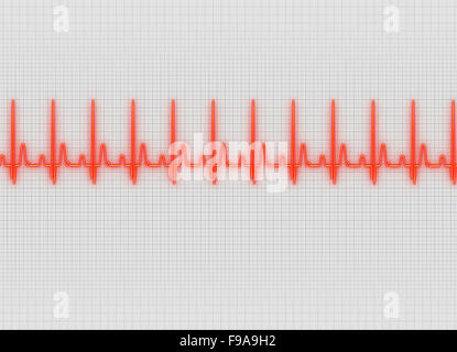 eine Elektrokardiographie Illustration in hellen Bildschirm-Hintergrund Stockfoto