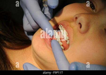 Ein Kieferorthopäde ist ein Zahnarzt, spezialisiert auf schiefe Zähne begradigen. Anpassung der geschweiften Klammern und Überprüfung Zähne & Biss. Stockfoto
