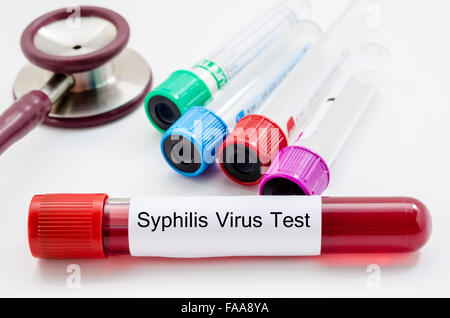 Syphilis-Virus Blut Sammlung Probenröhrchen mit Stethoskop auf weißem Hintergrund. Stockfoto