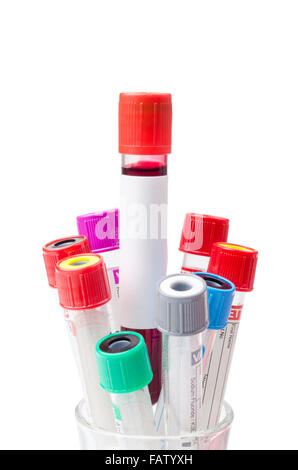 Vakuum-Röhren für Blut und sammeln von Proben im Labor Stockfoto