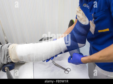 Gips auf einem gebrochenen Bein Stockfoto