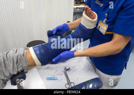 Gips auf einem gebrochenen Bein Stockfoto