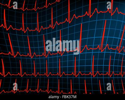 ECG Verfolgung Monitor. EPS 8 Stock Vektor