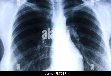 Röntgenbild Stockfoto