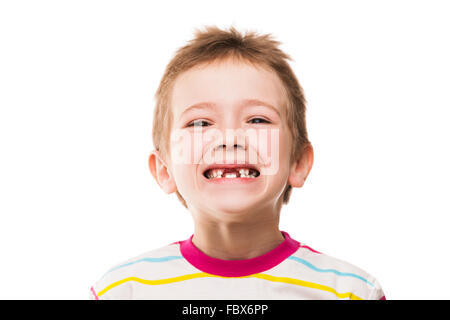 Erste Babymilch oder temporäre Zähne fallen aus Stockfoto