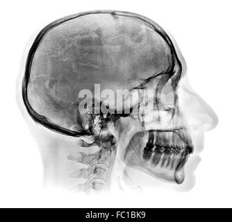 Detaillierten menschlicher Schädel Röntgenbild Stockfoto