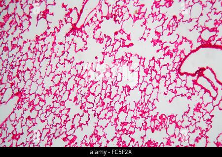 Lungenzellen unter dem Mikroskop Stockfoto