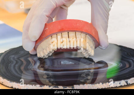 Zahnersatz, Prothese Stockfoto