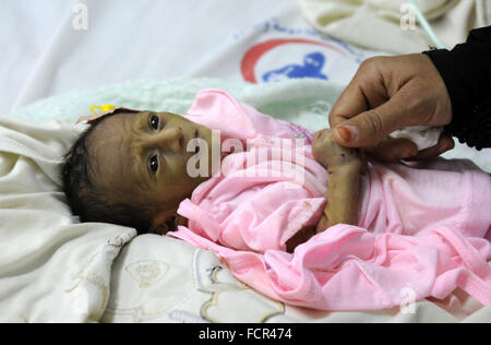 Sanaa, Jemen. 24. Januar 2016. Eine Frau fängt ihr unterernährten Kind, als er am Bett warten auf Behandlung in einem Krankenhaus in Sanaa, Jemen, am 24. Januar 2016 liegt. Jemenitische Kinder haben Schwierigkeiten bei der Behandlung der Zeit Krankenhäuser leiden Engpass in der Belieferung nach zehn Monaten der Blockade März 2015 durch die Saudi-geführte Koalition auferlegt. © Hani Ali/Xinhua/Alamy Live-Nachrichten Stockfoto