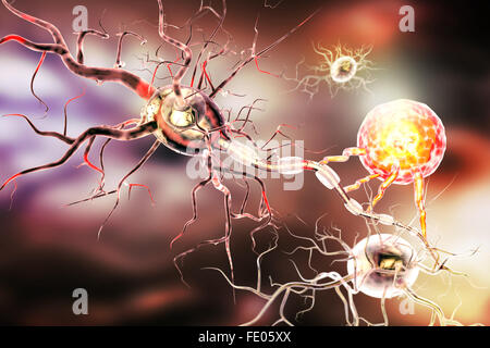 Nervenzellen, Konzept für neurologische Erkrankungen, Tumoren und Gehirn-Chirurgie. Stockfoto