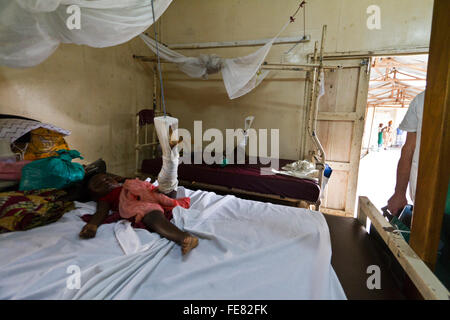 Hersteller von orthopädischen und Pediatric Pflege im Krankenhaus MSF Rutshuru, Nord-Kivu, demokratische Republik Kongo, demokratische Republik Kongo, Afrika Stockfoto