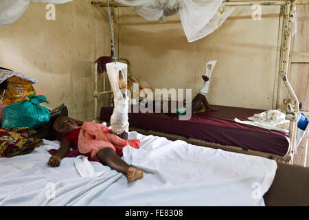 Hersteller von orthopädischen und Pediatric Pflege im Krankenhaus MSF Rutshuru, Nord-Kivu, demokratische Republik Kongo, demokratische Republik Kongo, Afrika Stockfoto