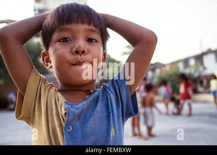 Kleine Straße junge mit einer Gaumenspalte steht vor der Kamera mit den Händen auf dem Kopf auf den Philippinen Stockfoto