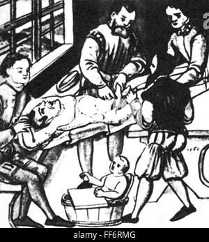 Medizin, Chirurgie, Hernie, aus: Caspar Stromayr (+ 1566 / 1567), 'Practica copiosa', Lindau, 1559, Additional-Rights-Clearences-not available Stockfoto