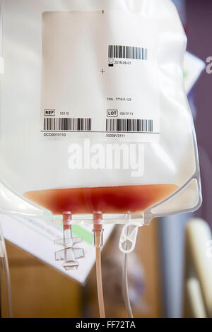 Stammzellen sind in eine Tasche in der Londoner Klinik, London, UK gepumpt.  Die Stammzellen sind getrennt und aus einer Bluttransfusion Spender gesammelt und dienen als lebensrettende allogenen für eine unabhängige Person mit Sever Blutkrebs Transplantation. Stockfoto