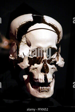 Impressionen - Eroeffnung des "Menschen Museen" Mit Plastinaten von Menschlichen Koerpern, Alexanderplatz, 17. Februar 2015, werden Stockfoto