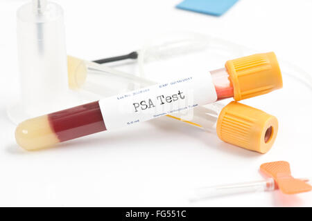 PSA-Analyse Sammelröhrchen mit Blutentnahme liefert.  Seriennummer ist zufällig, Etiketten und Dokumentation sind fiktiv und cr Stockfoto