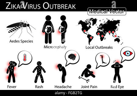 Zika Virus Ausbrüchen Infografiken (Moskitos (Aedes-Arten) ist Träger, Mikrozephalie im Fötus, Umgebung Ausbruch, sympto Stockfoto