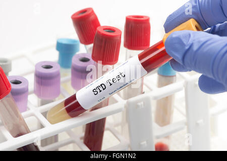 STD Blut Analyse Sammlung Reagenzglas durch Techniker ausgewählt.  Seriennummer ist zufällig, Etiketten und Dokument sind fiktiv ein Stockfoto