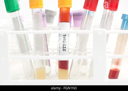 STD Blut Analyse Sammelröhrchen mit Reagenzglas Gestell.  Etiketten und Dokument sind fiktiv und vom Fotografen erstellt. Stockfoto