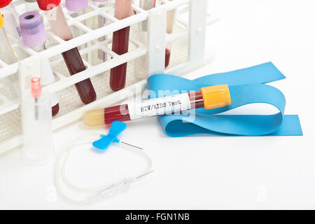 HIV Blut Analyse Sammelröhrchen mit Rohr Rack.  Etiketten und Dokument sind fiktiv und vom Fotografen erstellt. Stockfoto