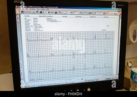Florida, South, FL, Miami Beach, Mount Mt Sinai Medical Center, Zentrum, Krankenhaus, Arztpraxis, Monitor, Bildschirm, EKG, Ruhe, Elektrokardiogramm, Herz, Rhythmus Stockfoto