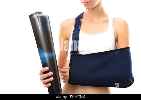 Eine Frau mit einem gebrochenen Arm in einer Schlinge, die im Besitz einer Hand einer Röntgenaufnahme. Die Hand in einer Schlinge Stockfoto