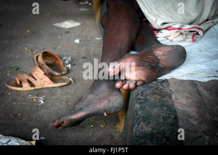 Schmutzige Füße von Armen und Obdachlosen in der Nähe der Howrah Station, Kolkata, Indien Stockfoto