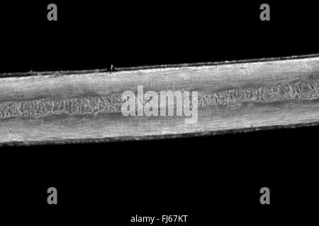 Menschen, Menschen, Menschen (Homo Sapiens sapiens), menschliches Haar, mikroskopische Stockfoto