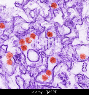 Dies ist ein digital eingefärbt Transmission Electron Schliffbild (TEM) der Zika-Virus, das ein Mitglied der Familie Flaviviridae. Viruspartikel, hier rot, sind 40 nm im Durchmesser, mit einer äußeren Hülle und einen inneren dichten Kern. Das Bild entstand durch die CDC / Cynthia Goldsmith