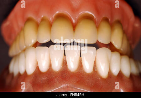 Nahaufnahme eines Satzes von Zahnersatz. Stockfoto