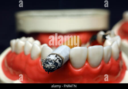 Nahaufnahme einer unteren Reihe von Zahnersatz mit einer Zigarette zwischen den Zähnen. Stockfoto