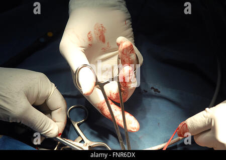 Nahaufnahme des Chirurgen behandschuhten Hände mit Pinzette. Stockfoto